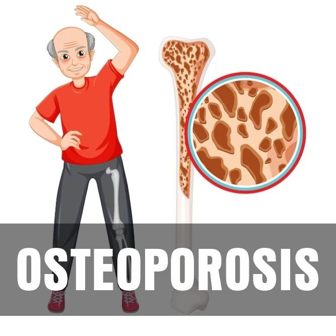 OSTEOPOROSIS